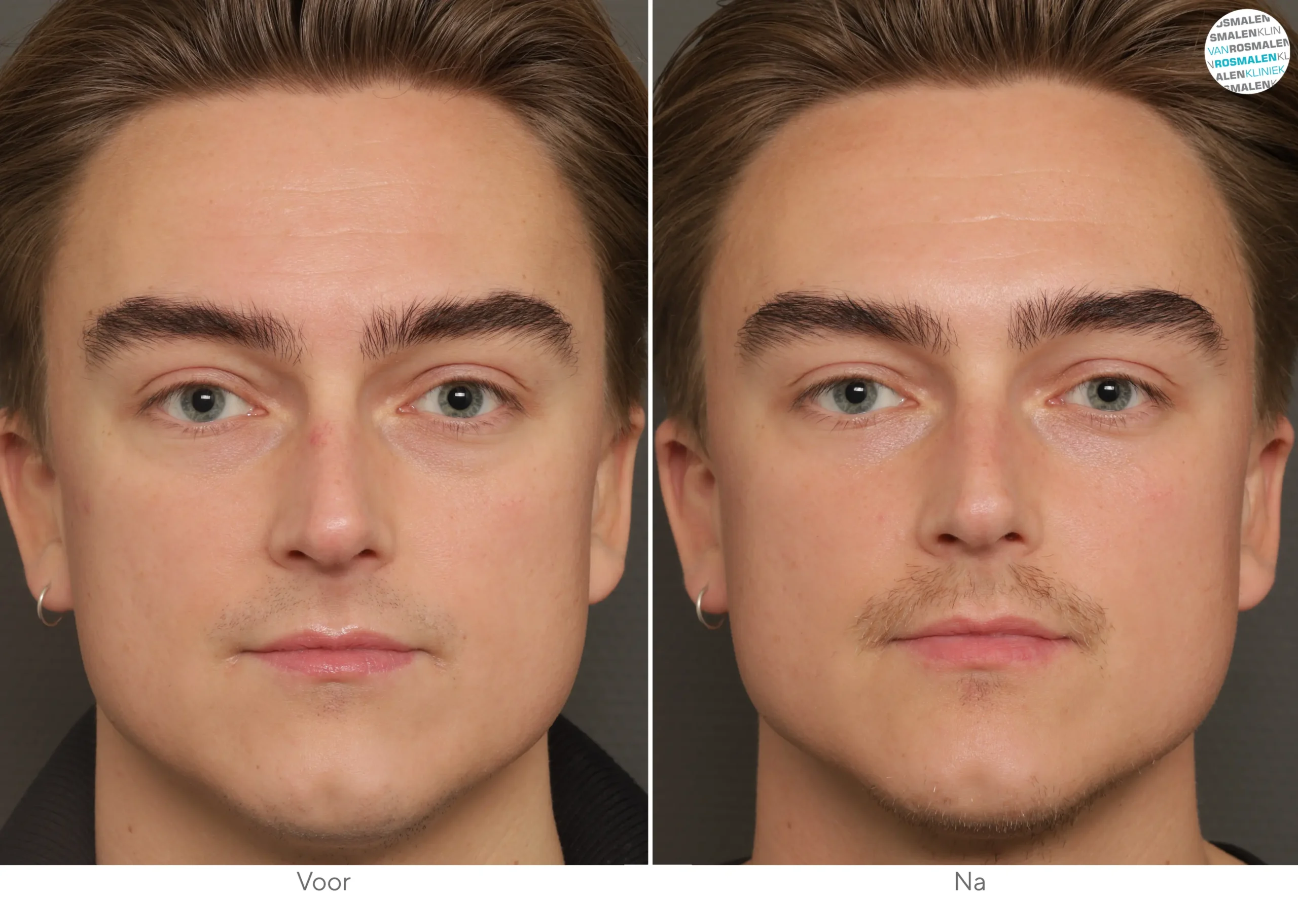 GLOW Sensitive Couperose